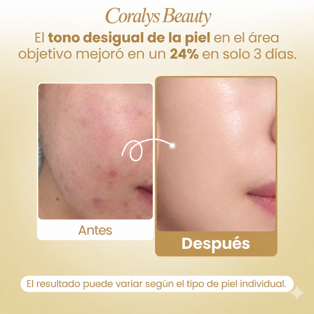 GoldMask — Mascarilla Nocturna Peel-Off de Cúrcuma y Ácido Kójico